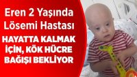Kök Hücre Bulunmazsa 1 Aylık Ömrü Kaldı!!
