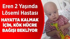 Kök Hücre Bulunmazsa 1 Aylık Ömrü Kaldı!!